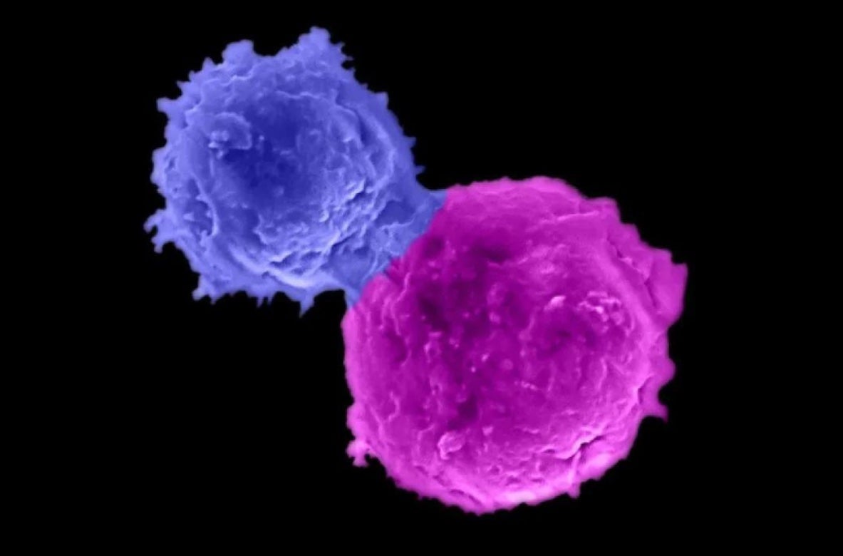Microscopy image showing an allogeneic BCMA-targeting CAR-armed and IL-15-enhanced NKT cell (BCAR-NKT cell; blue) attacking a human multiple myeloma cell (MM.1S cell; magenta). 
