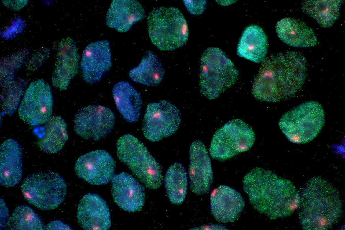 Induced pluripotent stem cells in blue and green derived from a woman’s skin