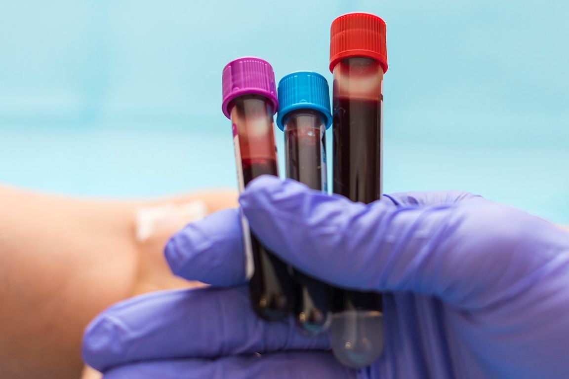 Purple-gloved hand holding three full blood collection tubes