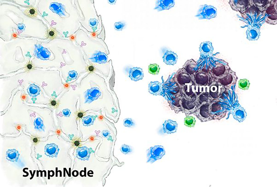 Illustration showing symphnode (white), tumor (purple) and T cells (blue)