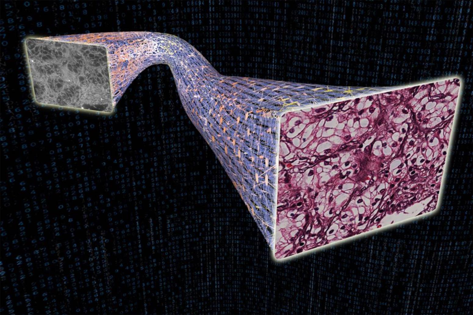 A (gray) unstained microscopic image at left and a pink AI-painted version at right